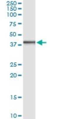 Immunoprecipitation: DNAJB6 Antibody (2D12-B9) [H00010049-M02]