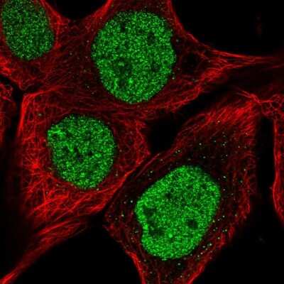 Immunocytochemistry/ Immunofluorescence: DNAJB6 Antibody [NBP2-49286]
