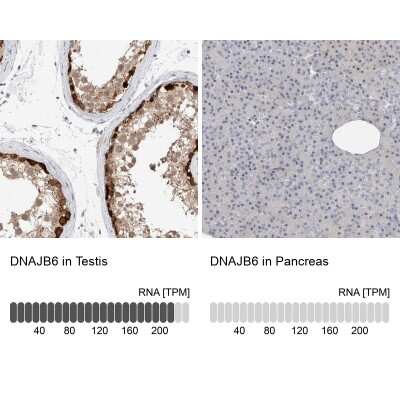 Immunohistochemistry-Paraffin: DNAJB6 Antibody [NBP1-82624]