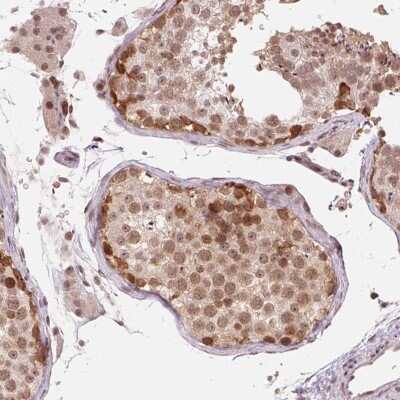 Immunohistochemistry-Paraffin: DNAJB6 Antibody [NBP2-49286]