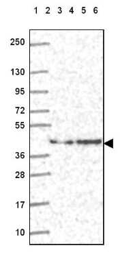 Western Blot: DNAJB6 Antibody [NBP2-49286]