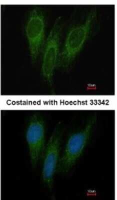 Immunocytochemistry/ Immunofluorescence: DNAJC1 Antibody [NBP1-32448]