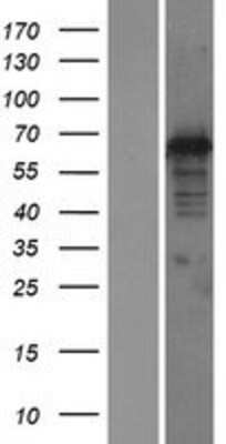 Western Blot: DNAJC1 Overexpression Lysate [NBP2-06442]