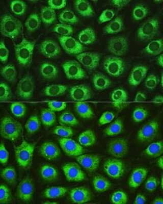 Immunocytochemistry/ Immunofluorescence: DNAJC10 Antibody - Azide and BSA Free [NBP2-92054]