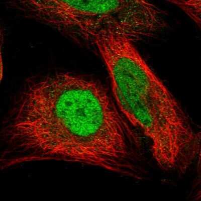 Immunocytochemistry/ Immunofluorescence: DNAJC17 Antibody [NBP1-84614]