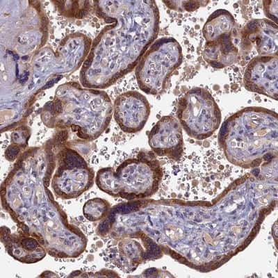 Immunohistochemistry-Paraffin: DNAJC17 Antibody [NBP1-84613]