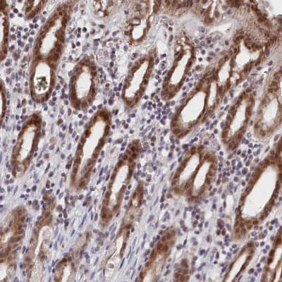 Immunohistochemistry-Paraffin: DNAJC17 Antibody [NBP1-84614]