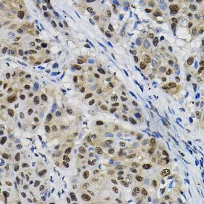 Immunohistochemistry-Paraffin: DNAJC17 Antibody - Azide and BSA Free [NBP3-15969]