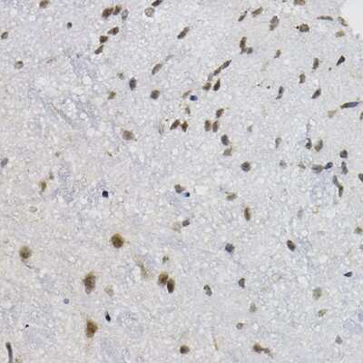 Immunohistochemistry-Paraffin: DNAJC17 Antibody - Azide and BSA Free [NBP3-15969]