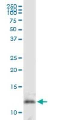 Western Blot: DNAJC19 Antibody [H00131118-B01P]