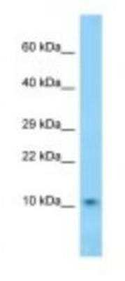 Western Blot: DNAJC19 Antibody [NBP1-98468]