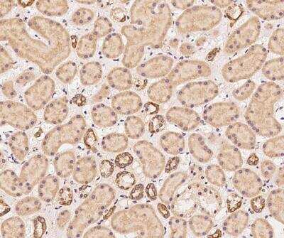 Immunohistochemistry-Paraffin: DNAJC2 Antibody [NBP3-12630]
