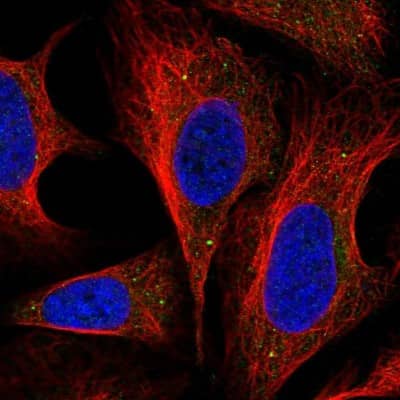 Immunocytochemistry/ Immunofluorescence: DNAJC22 Antibody [NBP2-58463]