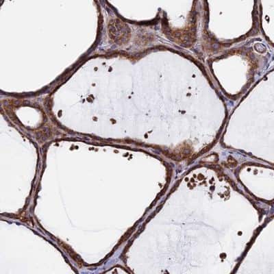 Immunohistochemistry-Paraffin: DNAJC3 Antibody [NBP2-48704]