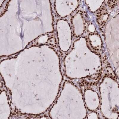 Immunohistochemistry-Paraffin: DNAJC3 Antibody [NBP2-48734]