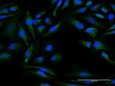 Immunocytochemistry/ Immunofluorescence: DNAJC30 Antibody [H00084277-B01P]