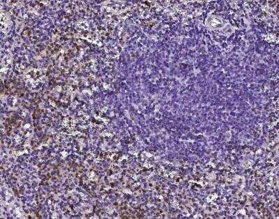 Immunohistochemistry-Paraffin: DNAJC30 Antibody [NBP3-12538]