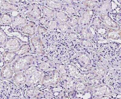 Immunohistochemistry-Paraffin: DNAJC30 Antibody [NBP3-12538]