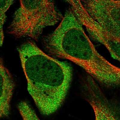 Immunocytochemistry/ Immunofluorescence: DNAJC6 Antibody [NBP1-81507]
