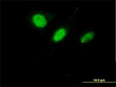 Immunocytochemistry/ Immunofluorescence: DNAJC7 Antibody (4G6-G3) [H00007266-M01]