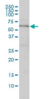 Western Blot: DNAJC7 Antibody (4G6-G3) [H00007266-M01]