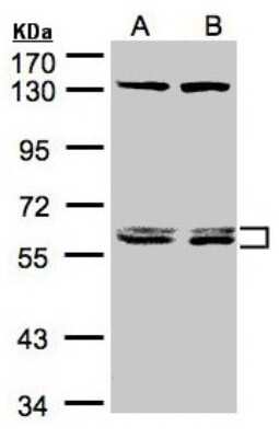 Western Blot: DNAJC7 Antibody [NBP1-32127]