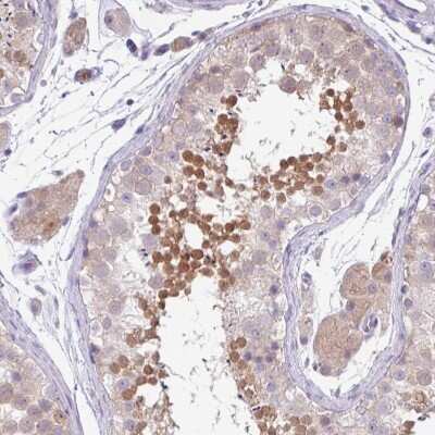 Immunohistochemistry-Paraffin: DNAL1 Antibody [NBP2-13929]