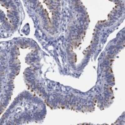 Immunohistochemistry-Paraffin: DNAL1 Antibody [NBP3-17701]