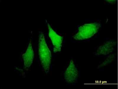 Immunocytochemistry/ Immunofluorescence: DNALI1 Antibody [H00007802-B01P]