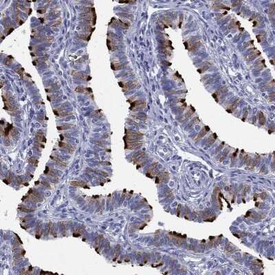 Immunohistochemistry-Paraffin: DNALI1 Antibody [NBP3-17031]