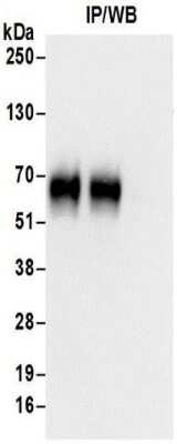 Immunoprecipitation: DNAM-1/CD226 Antibody [NBP2-32247]