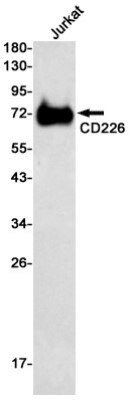 Western Blot: DNAM-1/CD226 Antibody (S03-4I5) [NBP3-20033]