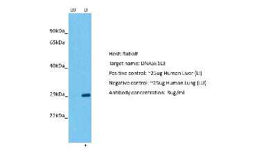 Western Blot: DNASE1L3 Antibody [NBP2-84008]