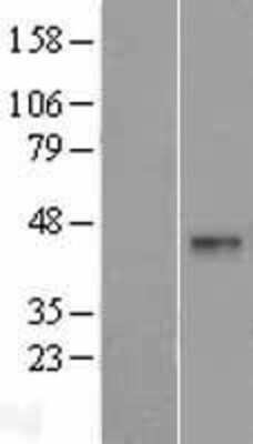 Western Blot: DNASE2B Overexpression Lysate [NBP2-06536]