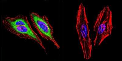Immunocytochemistry/ Immunofluorescence: DNCIC1 Antibody (74.1) [NB300-726]