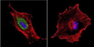 Immunocytochemistry/ Immunofluorescence: DNCIC1 Antibody (74.1) [NB300-726]