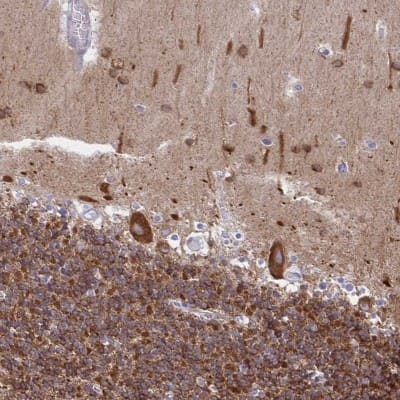 Immunohistochemistry-Paraffin: DNCIC1 Antibody [NBP2-38933]