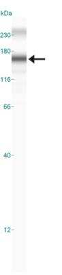 Simple Western: DNMT1 Antibody (60B1220.1)BSA Free [NB100-56519]