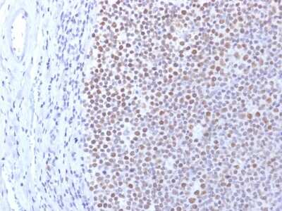 Immunohistochemistry-Paraffin: DNMT1 Antibody (DNMT1/2061) - Azide and BSA Free [NBP3-08482]