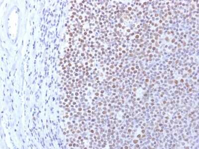 Immunohistochemistry-Paraffin: DNMT1 Antibody (DNMT1/2061) [NBP3-07671]