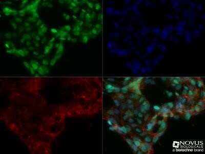 Immunocytochemistry/ Immunofluorescence: DNMT3A Antibody (64B1446) - Azide and BSA Free [NBP2-80699]