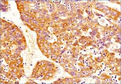 Immunohistochemistry: DNMT3A Antibody (64B1446) - Azide and BSA Free [NBP2-80699]
