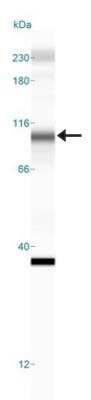Simple Western: DNMT3B Antibody [NB300-516]