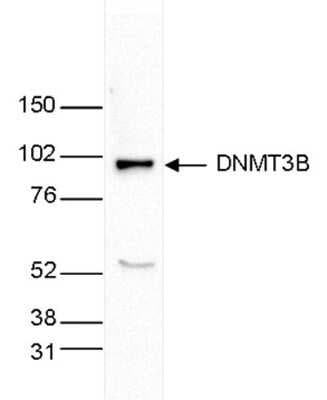Western Blot: DNMT3B Antibody [NBP2-59291]