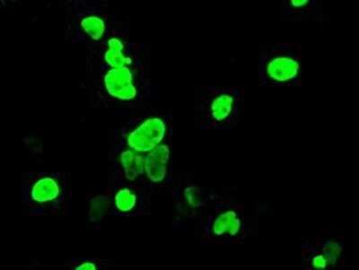 Immunocytochemistry/ Immunofluorescence: DNTTIP1 Antibody (OTI1F4) - Azide and BSA Free [NBP2-72352]
