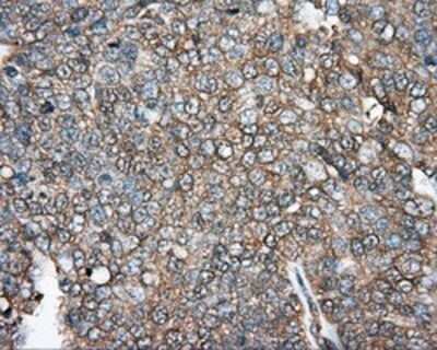 Immunohistochemistry: DNTTIP1 Antibody (OTI1F4) - Azide and BSA Free [NBP2-72352]