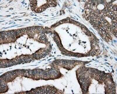 Immunohistochemistry-Paraffin: DNTTIP1 Antibody (OTI1F4) [NBP2-02507]