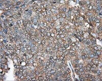 Immunohistochemistry-Paraffin: DNTTIP1 Antibody (OTI1F4) [NBP2-02507]