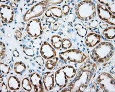 Immunohistochemistry-Paraffin: DNTTIP1 Antibody (OTI1F4) [NBP2-02507]