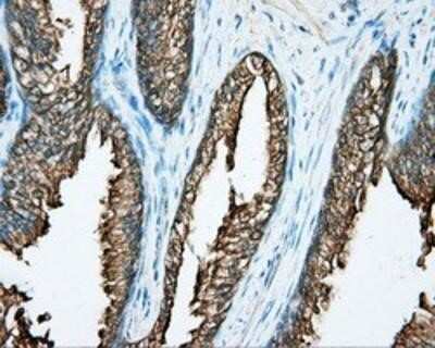 Immunohistochemistry-Paraffin: DNTTIP1 Antibody (OTI1F4) [NBP2-02507]